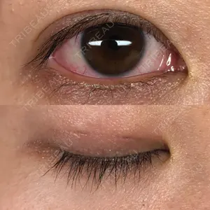 TCB東京中央美容外科 TCB東京中央美容外科 京都駅前院口コミ