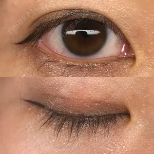 TCB東京中央美容外科 TCB東京中央美容外科 京都駅前院口コミ