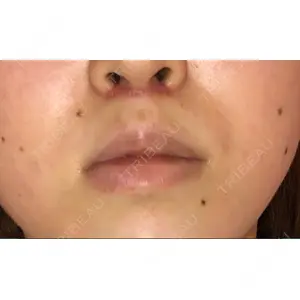B-LINE CLINIC B-LINE CLINIC 池袋院口コミ
