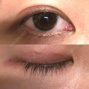 TCB東京中央美容外科 TCB東京中央美容外科 京都駅前院口コミ