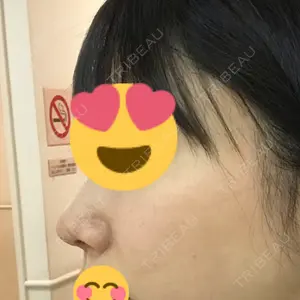 RG整形外科（旧リオン整形外科）口コミ