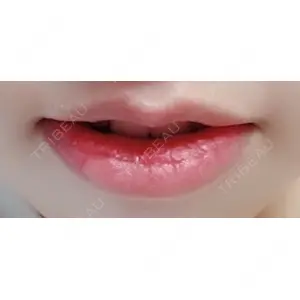 B-LINE CLINIC B-LINE CLINIC 池袋院口コミ