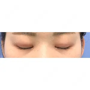 口コミ