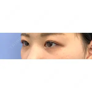 口コミ
