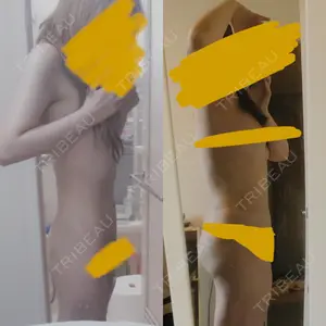 狎鴎亭トップライン医院口コミ