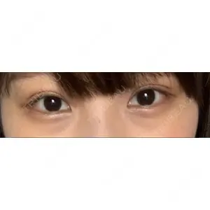 湘南美容クリニック 湘南美容クリニック 赤坂見附院口コミ