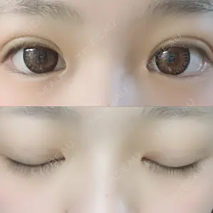 湘南美容クリニック 湘南美容クリニック 赤坂見附院口コミ