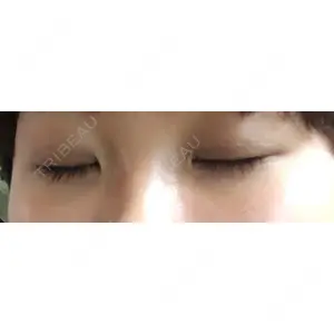 マーブル美容整形外科の