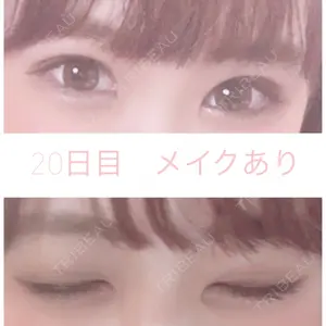 湘南美容クリニック 湘南美容クリニック 赤坂見附院口コミ