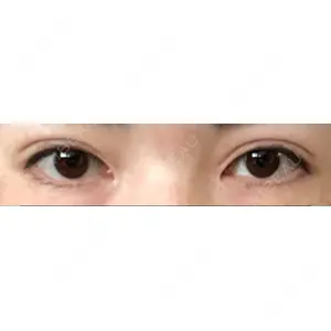 POP美容整形クリニック口コミ