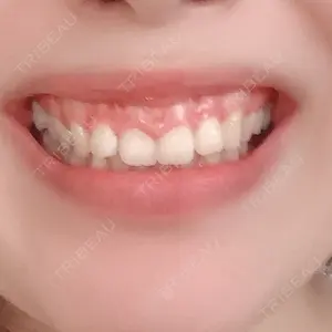 口コミ