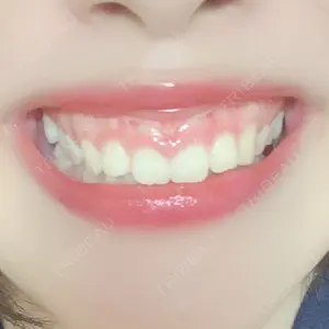 口コミ