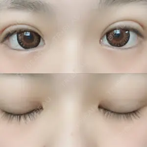 湘南美容クリニック 湘南美容クリニック 赤坂見附院口コミ