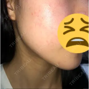 ボンディ美容整形外科（旧リオン整形外科）口コミ