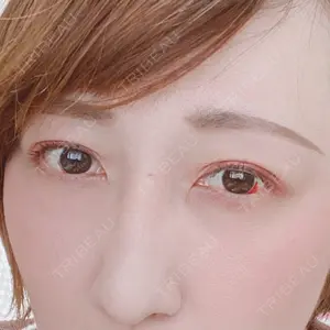 id美容外科の口コミ