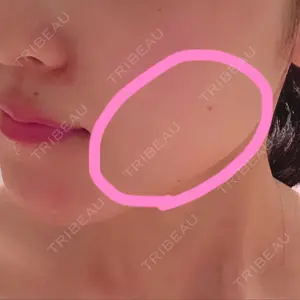 赤坂プレミアクリニック口コミ