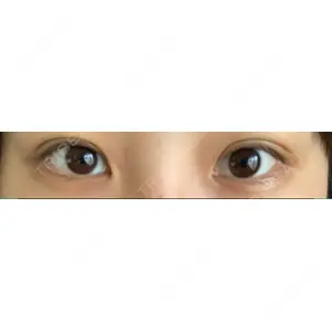 湘南美容クリニック 湘南美容クリニック 赤坂見附院口コミ