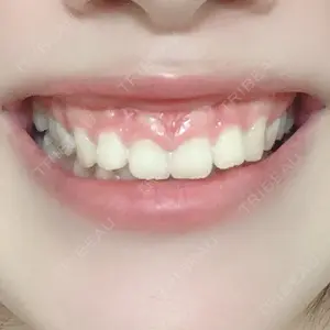 口コミ