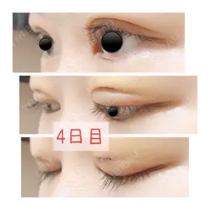 口コミ