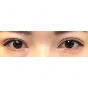 POP美容整形クリニック口コミ
