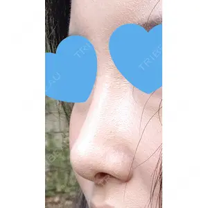 口コミ