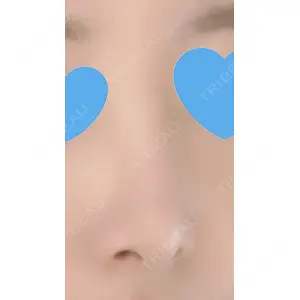 口コミ