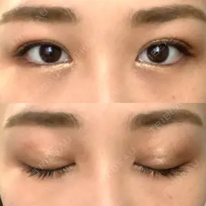 湘南美容クリニック 湘南美容クリニック 西宮北口院口コミ