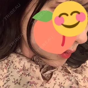 ボンディ美容整形外科（旧リオン整形外科）口コミ