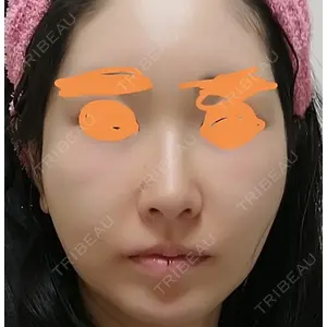 ソウルクイーン整形外科（旧コエンミ整形外科）口コミ