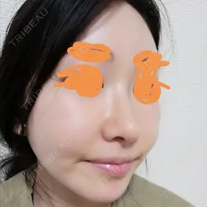 ソウルクイーン整形外科（旧コエンミ整形外科）口コミ