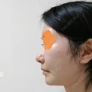 ソウルクイーン整形外科（旧コエンミ整形外科）口コミ