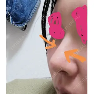 ソウルクイーン整形外科（旧コエンミ整形外科）口コミ
