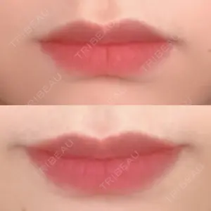 南青山スキンケアクリニック口コミ
