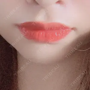 南青山スキンケアクリニック口コミ