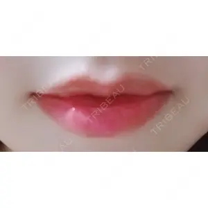 B-LINE CLINIC B-LINE CLINIC 池袋院口コミ