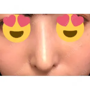 HANABI整形外科口コミ