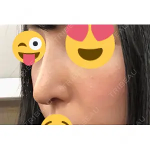 HANABI整形外科口コミ