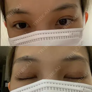 湘南美容クリニック 湘南美容クリニック 池袋東口院口コミ