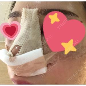 ビーザニュー美容整形外科（旧コノピ美容整形外科）口コミ