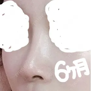 マーブル整形外科口コミ