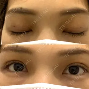 湘南美容クリニック 湘南美容クリニック 池袋東口院口コミ