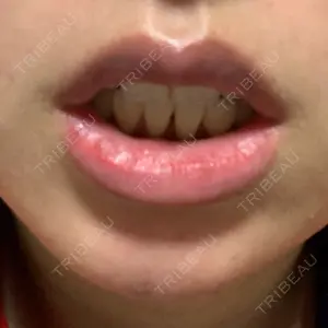 B-LINE CLINIC B-LINE CLINIC 池袋院口コミ