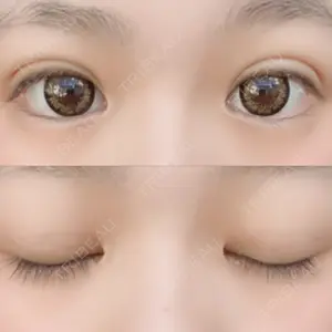 湘南美容クリニック 湘南美容クリニック 赤坂見附院口コミ