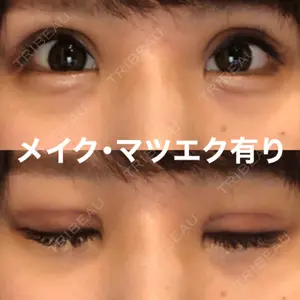 口コミ