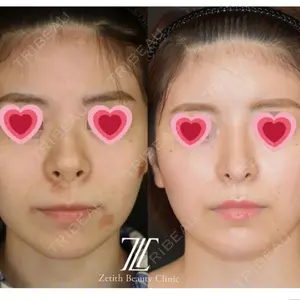 Zetith Beauty Clinic 銀座院口コミ