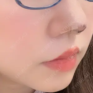 MIYAフェイスクリニックの