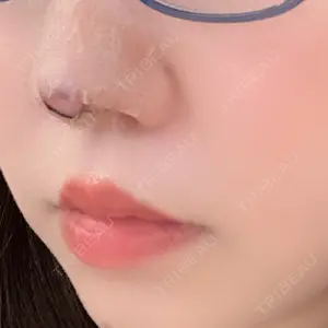 MIYAフェイスクリニックの