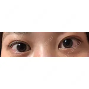 口コミ
