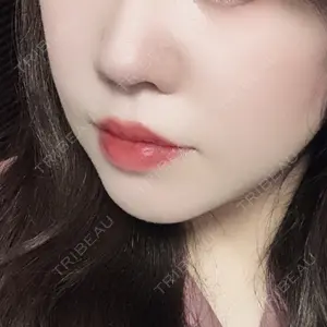 MIYAフェイスクリニックの