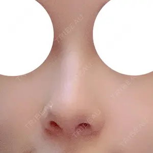 マーブル整形外科口コミ